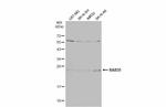 RAB35 Antibody in Western Blot (WB)