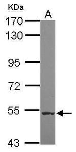 NAA16 Antibody in Western Blot (WB)