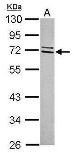 CCDC67 Antibody in Western Blot (WB)