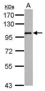 SLC9A8 Antibody in Western Blot (WB)