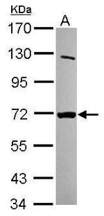 MTMR8 Antibody in Western Blot (WB)