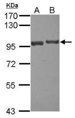 USP6NL Antibody in Western Blot (WB)