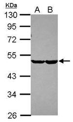 CHST7 Antibody in Western Blot (WB)