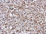 ERLIN1 Antibody in Immunohistochemistry (Paraffin) (IHC (P))