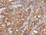 ERLIN1 Antibody in Immunohistochemistry (Paraffin) (IHC (P))