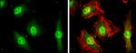 KIF23 Antibody in Immunocytochemistry (ICC/IF)