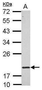 RNF5 Antibody in Western Blot (WB)