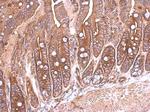 SEMA4B Antibody in Immunohistochemistry (Paraffin) (IHC (P))