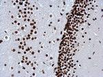 H3K27me3 Antibody in Immunohistochemistry (Paraffin) (IHC (P))