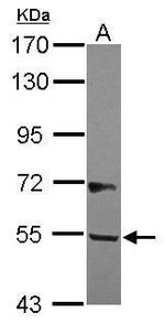 B3GALNT2 Antibody in Western Blot (WB)