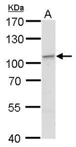 EXOC2 Antibody in Western Blot (WB)