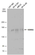 KDM6A Antibody in Western Blot (WB)