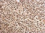 MAGEB18 Antibody in Immunohistochemistry (Paraffin) (IHC (P))