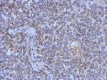 MRPL44 Antibody in Immunohistochemistry (Paraffin) (IHC (P))