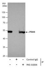 PDIA6 Antibody in Immunoprecipitation (IP)