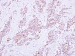 PSD4 Antibody in Immunohistochemistry (Paraffin) (IHC (P))