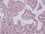 DUS2L Antibody in Immunohistochemistry (Paraffin) (IHC (P))