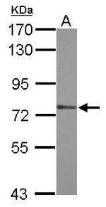 ZXDA Antibody in Western Blot (WB)