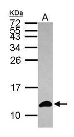 S100A6 Antibody in Western Blot (WB)