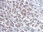 TFF1 Antibody in Immunohistochemistry (Paraffin) (IHC (P))