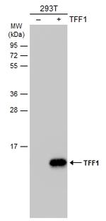 TFF1 Antibody in Western Blot (WB)