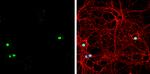 ZBTB20 Antibody in Immunocytochemistry (ICC/IF)