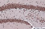 ZBTB20 Antibody in Immunohistochemistry (Paraffin) (IHC (P))