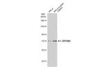 ZBTB20 Antibody in Western Blot (WB)