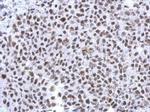 Histone H1.4 Antibody in Immunohistochemistry (Paraffin) (IHC (P))