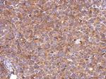 SLC25A46 Antibody in Immunohistochemistry (Paraffin) (IHC (P))