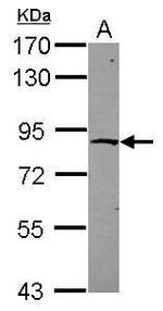 ZNF234 Antibody in Western Blot (WB)