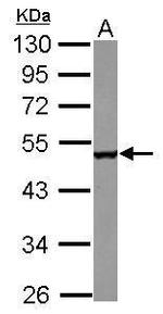 CPEB1 Antibody in Western Blot (WB)