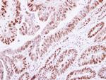 Histone H1.2 Antibody in Immunohistochemistry (Paraffin) (IHC (P))