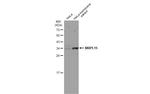 MRPL15 Antibody in Western Blot (WB)