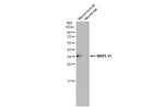 MRPL15 Antibody in Western Blot (WB)