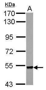 PLXNA4 Antibody in Western Blot (WB)