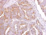 PEPP2 Antibody in Immunohistochemistry (Paraffin) (IHC (P))