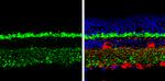 CPLX3 Antibody in Immunohistochemistry (Paraffin) (IHC (P))