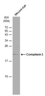 CPLX3 Antibody in Western Blot (WB)