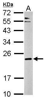 CPLX3 Antibody in Western Blot (WB)