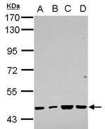 RBMY1F Antibody in Western Blot (WB)