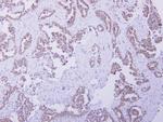 CBR4 Antibody in Immunohistochemistry (Paraffin) (IHC (P))