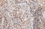 ULBP1 Antibody in Immunohistochemistry (Paraffin) (IHC (P))