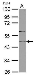 Clavesin-1 Antibody in Western Blot (WB)