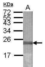 LONP2 Antibody in Western Blot (WB)