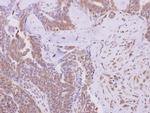 KBTBD3 Antibody in Immunohistochemistry (Paraffin) (IHC (P))