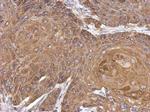 ALDH1A1 Antibody in Immunohistochemistry (Paraffin) (IHC (P))