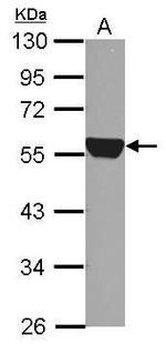 ALDH1A1 Antibody in Western Blot (WB)