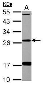 DHRS2 Antibody in Western Blot (WB)