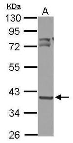 OXSM Antibody in Western Blot (WB)